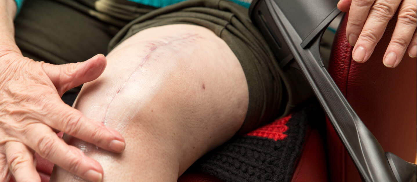 Post-Surgical Rehab Lafayette, LA